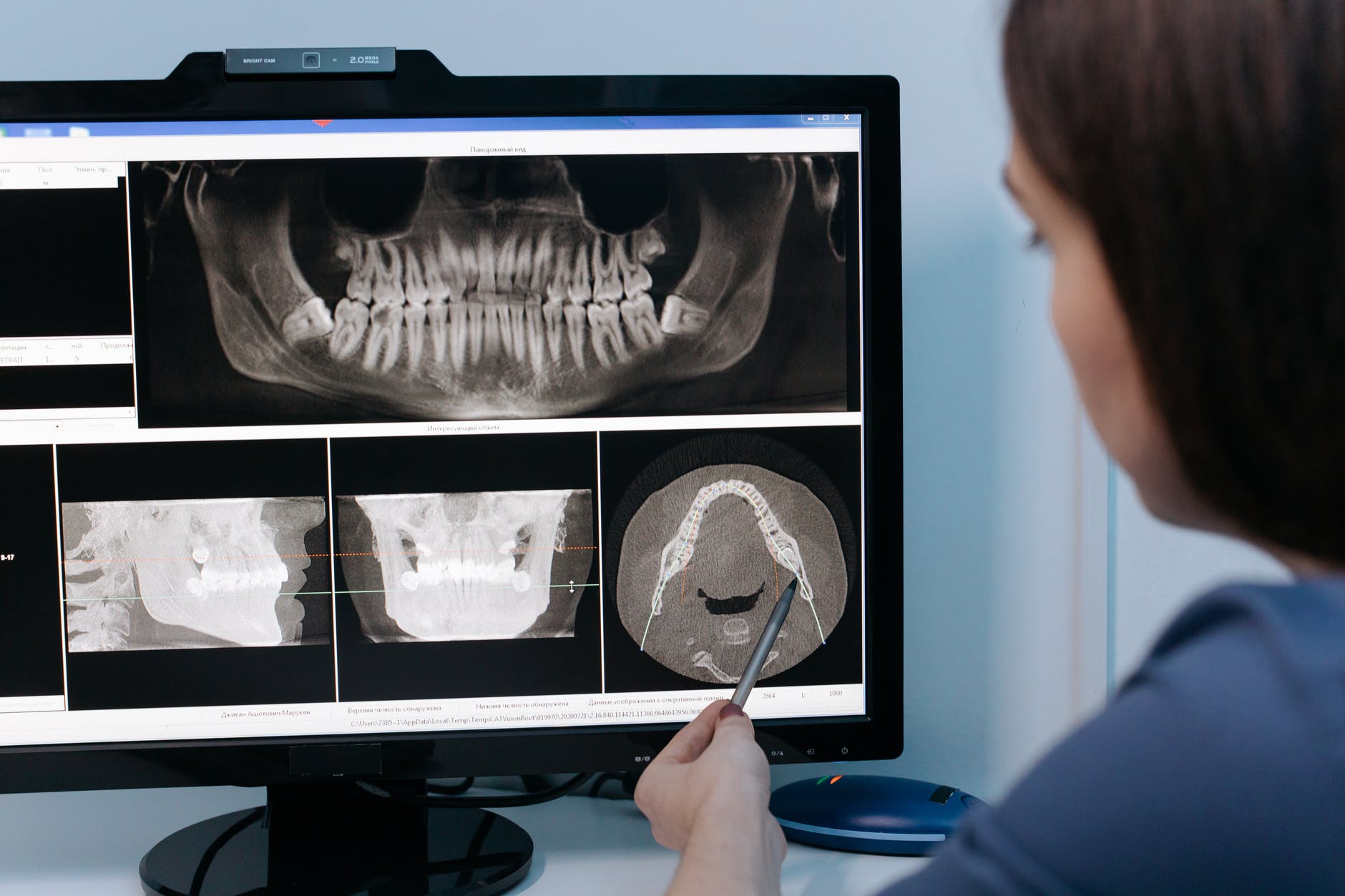 Exceptional Digital X-Ray Dental Services in Ammon, Idaho - Sunnyside ...